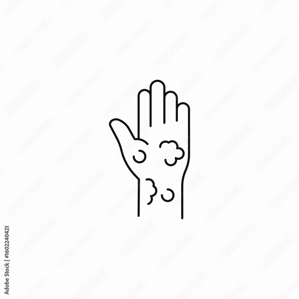 skin rash hand icon sign vector skin rash hand icon sign vector