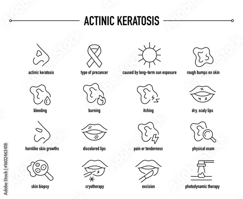 Actinic Keratosis symptoms, diagnostic and treatment vector icon set. Line editable medical icons