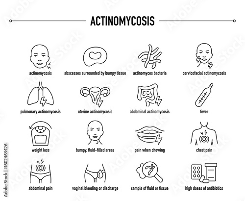 Actinomycosis symptoms, diagnostic and treatment vector icon set. Line editable medical icons