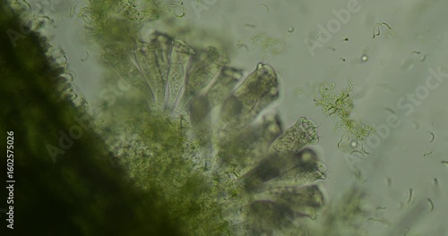 Microscopic view reveals vorticella, a stalked ciliate protist, exhibiting graceful movements of cilia and prominent food vacuoles within its bell shaped body