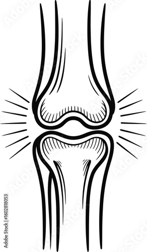 Hand drawn sketch of a human knee joint with radiating lines suggesting pain or inflammation