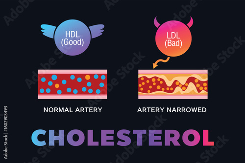 Cholesterol in artery, health risk , vector design