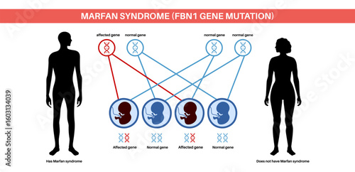 Marfan syndrome poster