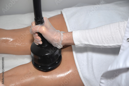 anti cellulite vibrating g5 massage subdermal therapy