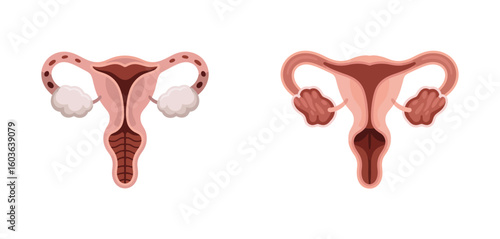 Anatomical illustrations of the female reproductive system