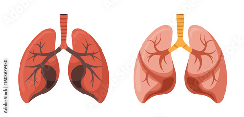 Comparison of healthy and diseased lungs illustration