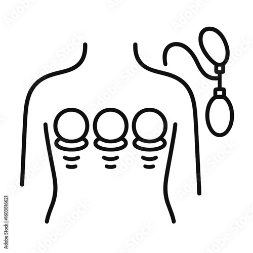 Vacuum cupping therapy equipment for body treatment illustration  