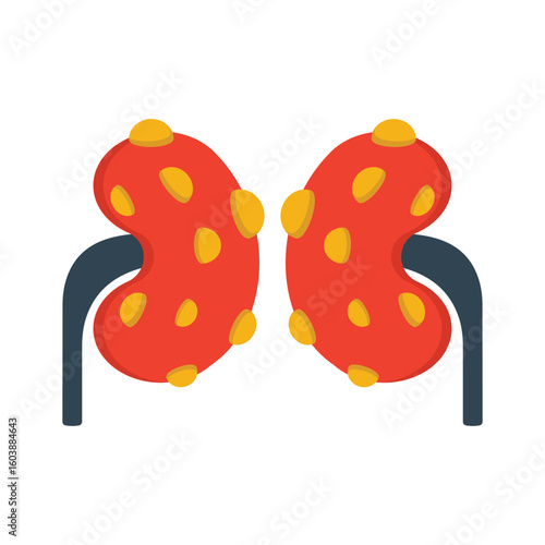 Renal Cyst Flat Vector Icon Eps 10 Files