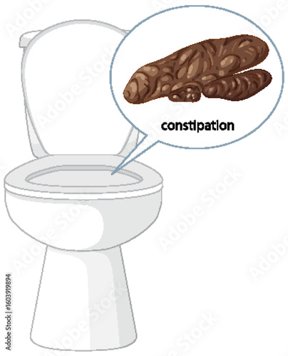 Constipation Illustration with Toilet and Stool Graphic