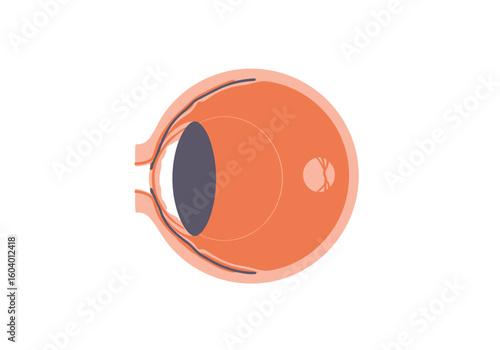 A simplified eye anatomy diagram shows lens retina and optic nerve