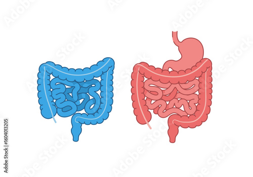 Anatomical illustration shows blue intestines beside a red colon and stomach