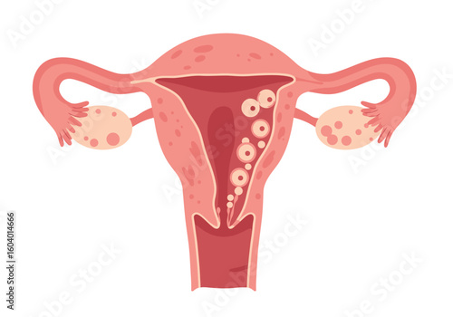 Pink uterus illustration with fallopian tubes and ovaries on a white background