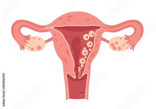 Pink uterus illustration with fallopian tubes and ovaries on a white background
