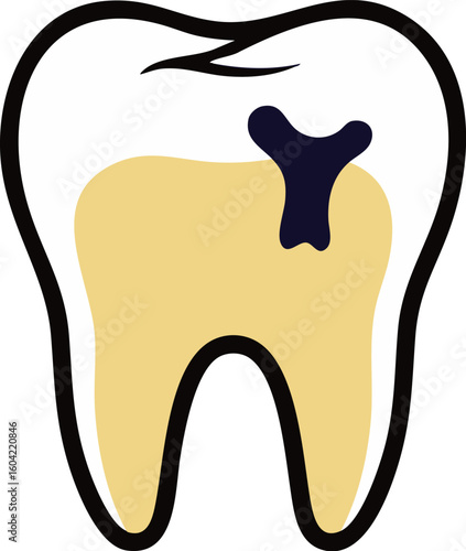 tooth with cavity, yellow and black clip art preview