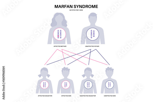 Marfan syndrome poster