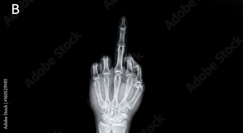 A stark X-ray of a human hand shows the middle finger extended, symbolizing rebellion, defiance, rudeness, protest, and a strong, controversial statement, often associated with negative emotions.