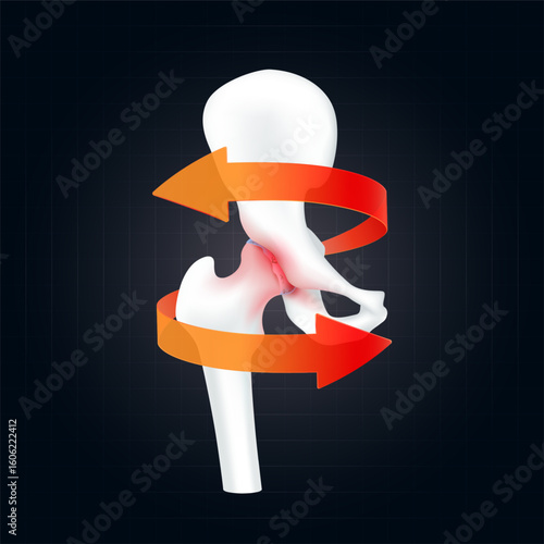 Arthritis and osteoarthritis. Red rotating arrow around hip joint cartilage inflammation on dark background. Human femur skeleton anatomy. For design medical or scientific treatments. Vector EPS10.
