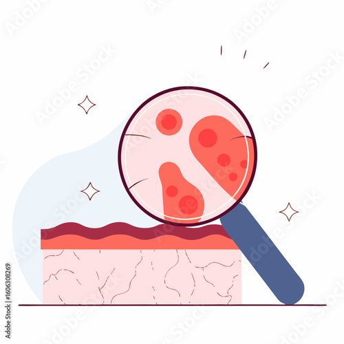 Skin with red rash under magnifying glass illustration
