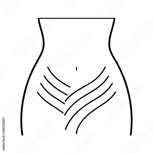 Curved Belly with Stretch Marks Vector Illustration of Skin Imperfections
