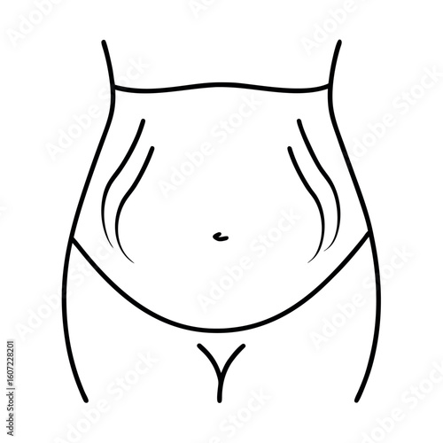 Curved Belly with Stretch Marks Vector Illustration of Skin Imperfections
