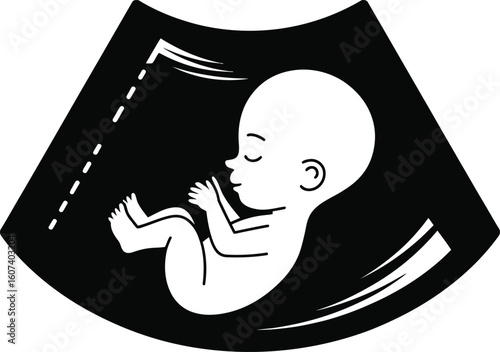 Baby Ultrasound Icon – Fetus Silhouette in Womb Medical Scan Vector