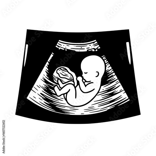 Line drawing of a fetus in an ultrasound image, isolated vector image on transparent background