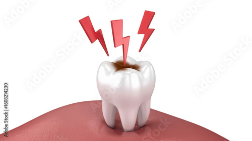 Toothache agony with painful decay, dentist visit needed for urgent care, dental health concern, tooth decay crisis, oral hygiene emergency, lightning bolts pain