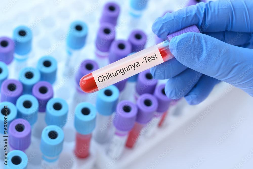 Naklejka premium Doctor holding a blood sample tube with Chikungunya test label in front of medical test tubes,symbolizing laboratory diagnosis, virus detection, healthcare,Alphavirus,mosquito-borne disease prevention
