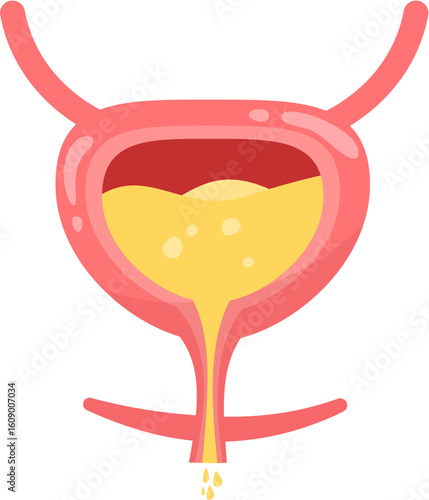 Urinary incontinence