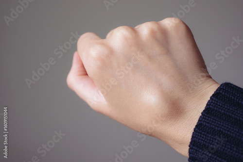 Female right back hand with ganglion cyst on the dorsum,  fluid-filled bump associated with a joint or tendon sheath, close-up view, selected focus.