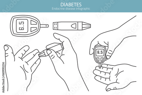Diabetes. Endocrine diseases. Medical infographic design. Vector illustration