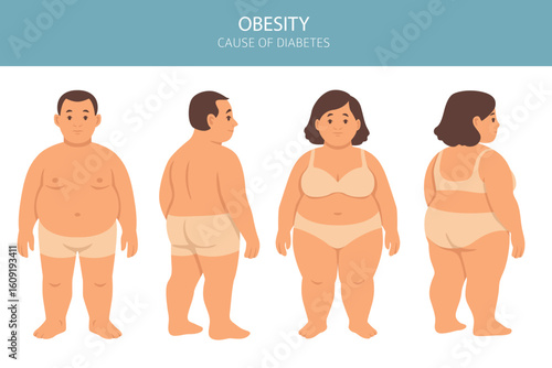 Flat vector illustration of an overweight man and woman shown from front and back views. Medical and health infographic about obesity and diabetes risks