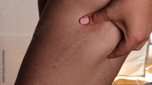 woman pinching thigh skin showing cellulite and uneven texture in soft daylight indoor environment concept of skincare and body awareness