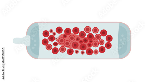 Blood clot