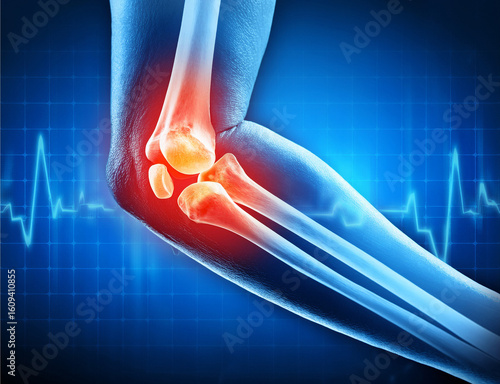 Ellbogengelenk mit schmerzen - 1