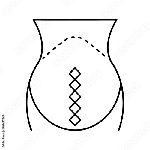 Pregnancy Illustration Braxton Hicks Contractions with Zigzag Lines on a Belly Shape