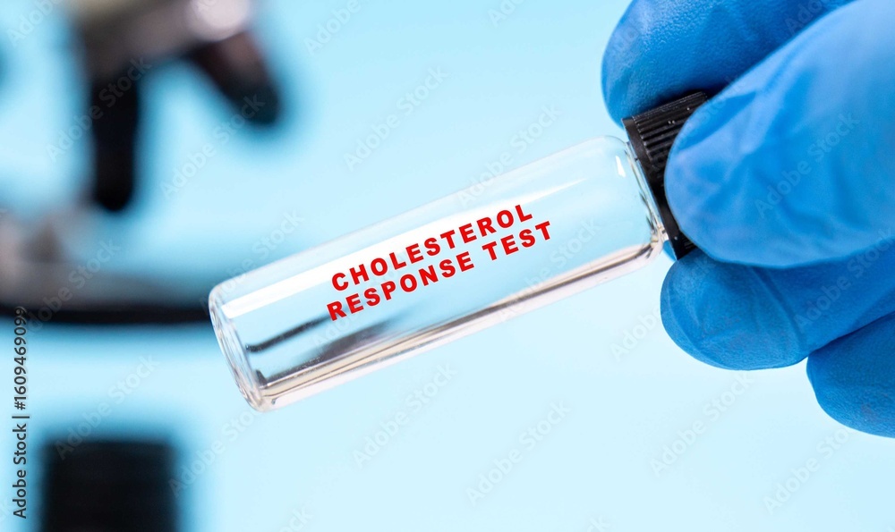Obraz premium Screens for genetic response to dietary cholesterol.