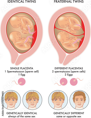 Illustration shows the difference between identical twins and fraternal twins, and why this happens, with annotations.