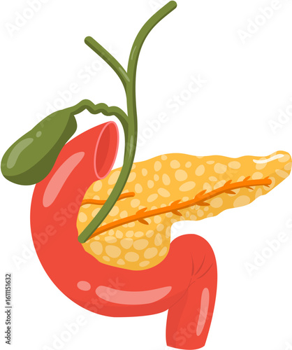 Reverse pancreas divisum 