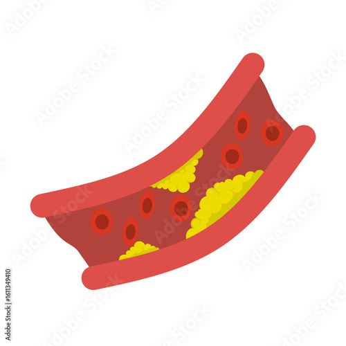 Vector illustration of clogged blood vessels, cholesterol, and fatty deposits on a white background
