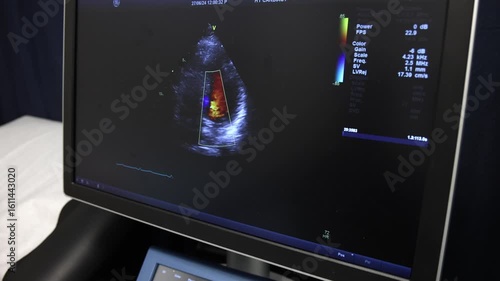 Medical monitor showin a live ultrasound image of the human heart during an echocardiogram exam