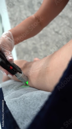 Vertical Close up video of professional cosmetologist doing laser hair removal of legs to young woman in beauty salon, Body care epilation treatment.