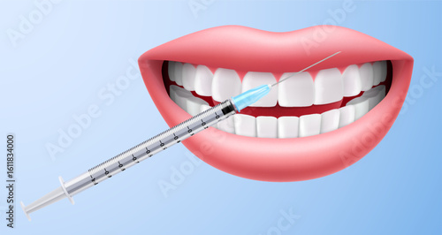Lips and botox injection. Female lips and injection syringe, lip augmentation procedure with hyaluronic acid, botox or filler. Realistic 3d vector illustration