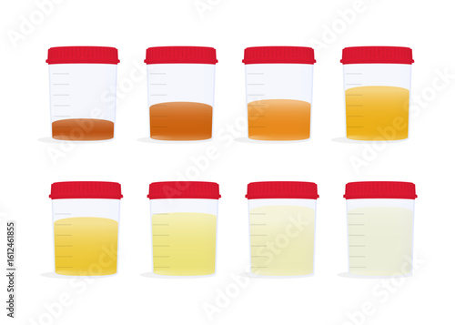 Urine samples with different coloured stock illustrations