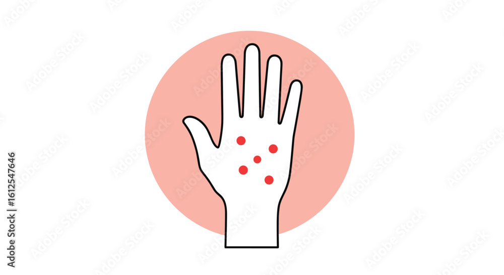 Obraz premium Understanding Common Causes and Treatments for Red Spots on the Hands a Guide for Diagnosis and Relief