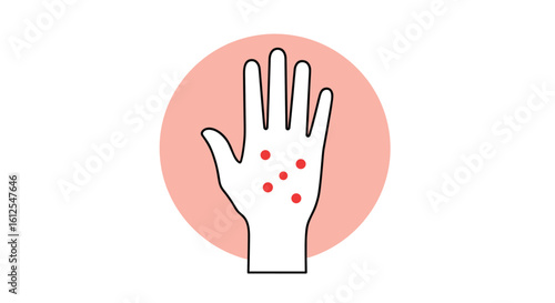 Understanding Common Causes and Treatments for Red Spots on the Hands a Guide for Diagnosis and Relief