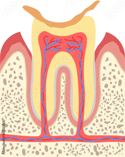 Tooth abrasion 