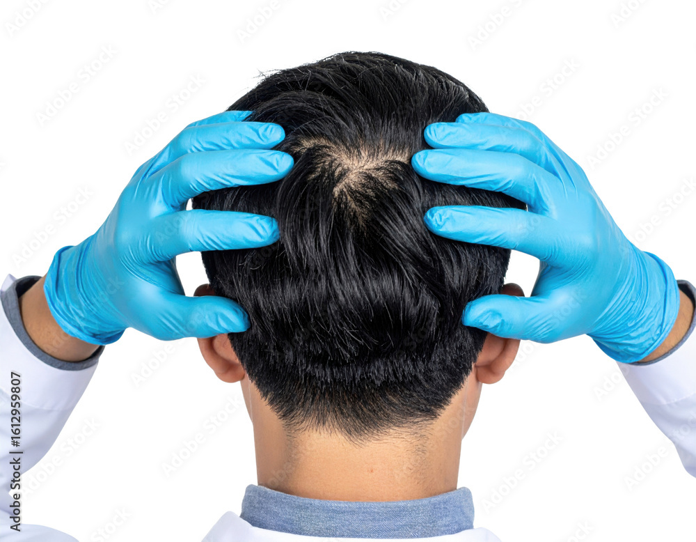Fototapeta premium A person wearing blue medical gloves examines the scalp of their head, focusing on hair and skin health.