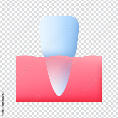 Incisor Tooth Design
