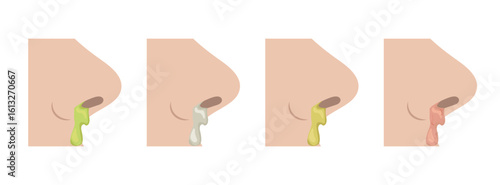 Different colors of mucus dripping from nose representing various stages of illness